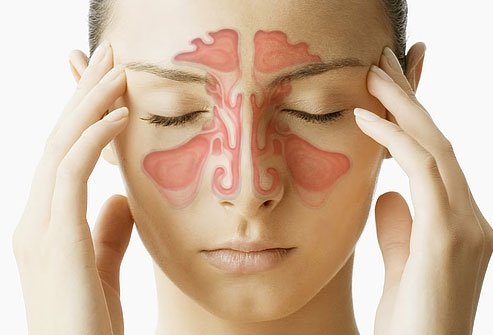 Sinusitis Treatment in Noida