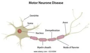 Motor Neuron Disease