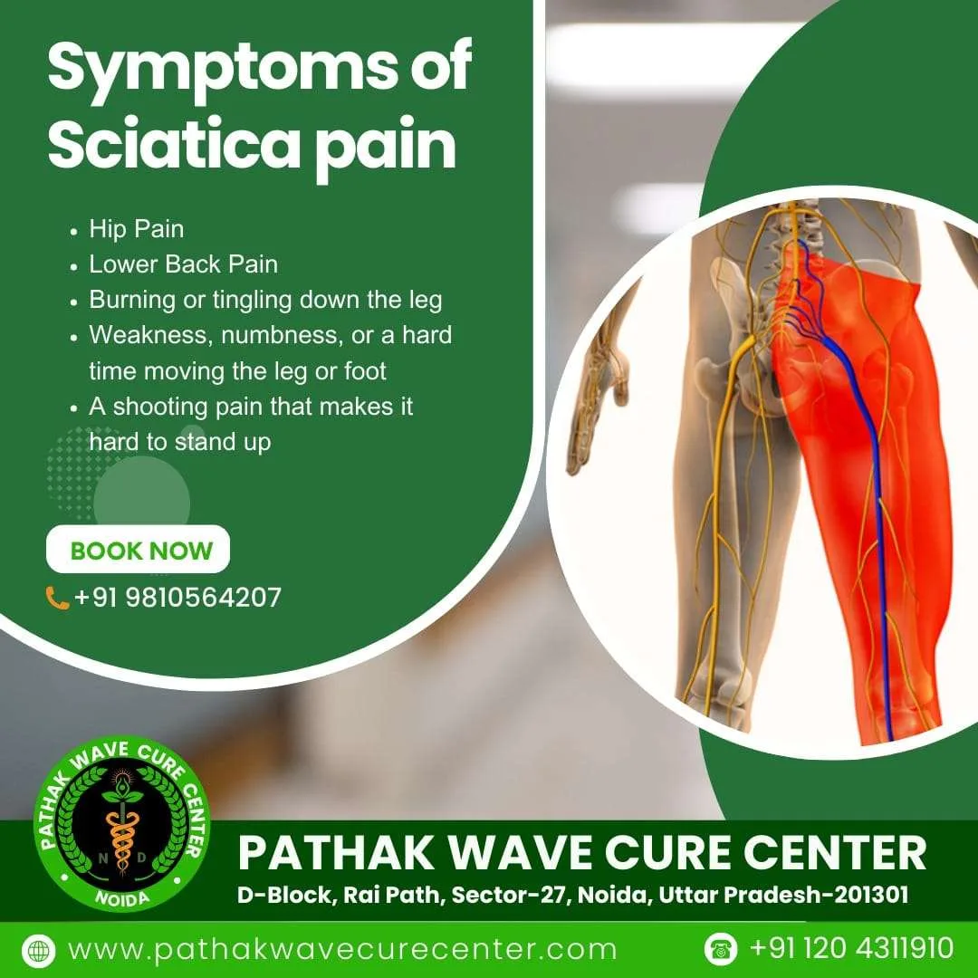 Sciatica Nerve