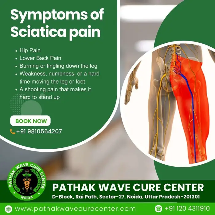 Sciatica Nerve